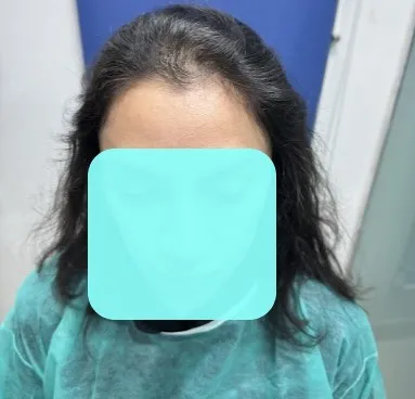 Hair transplant clinic facilities