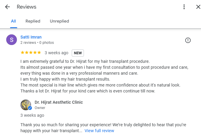 hair transplant in Islamabad