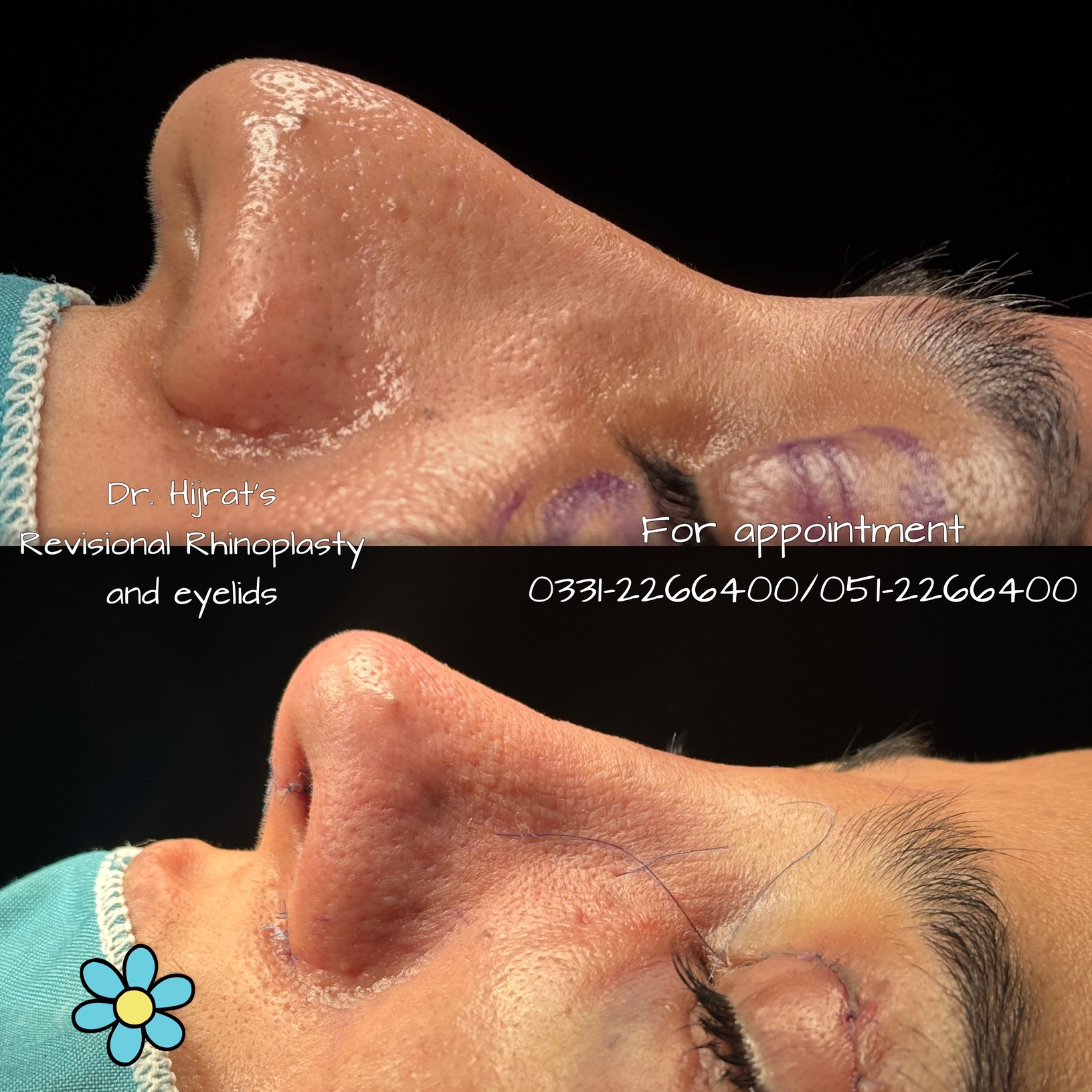 case 13 - Before